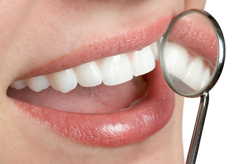 AAA Dental Care Dental Offer